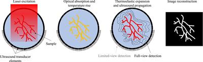 Sound out the impaired perfusion: Photoacoustic imaging in preclinical ischemic stroke